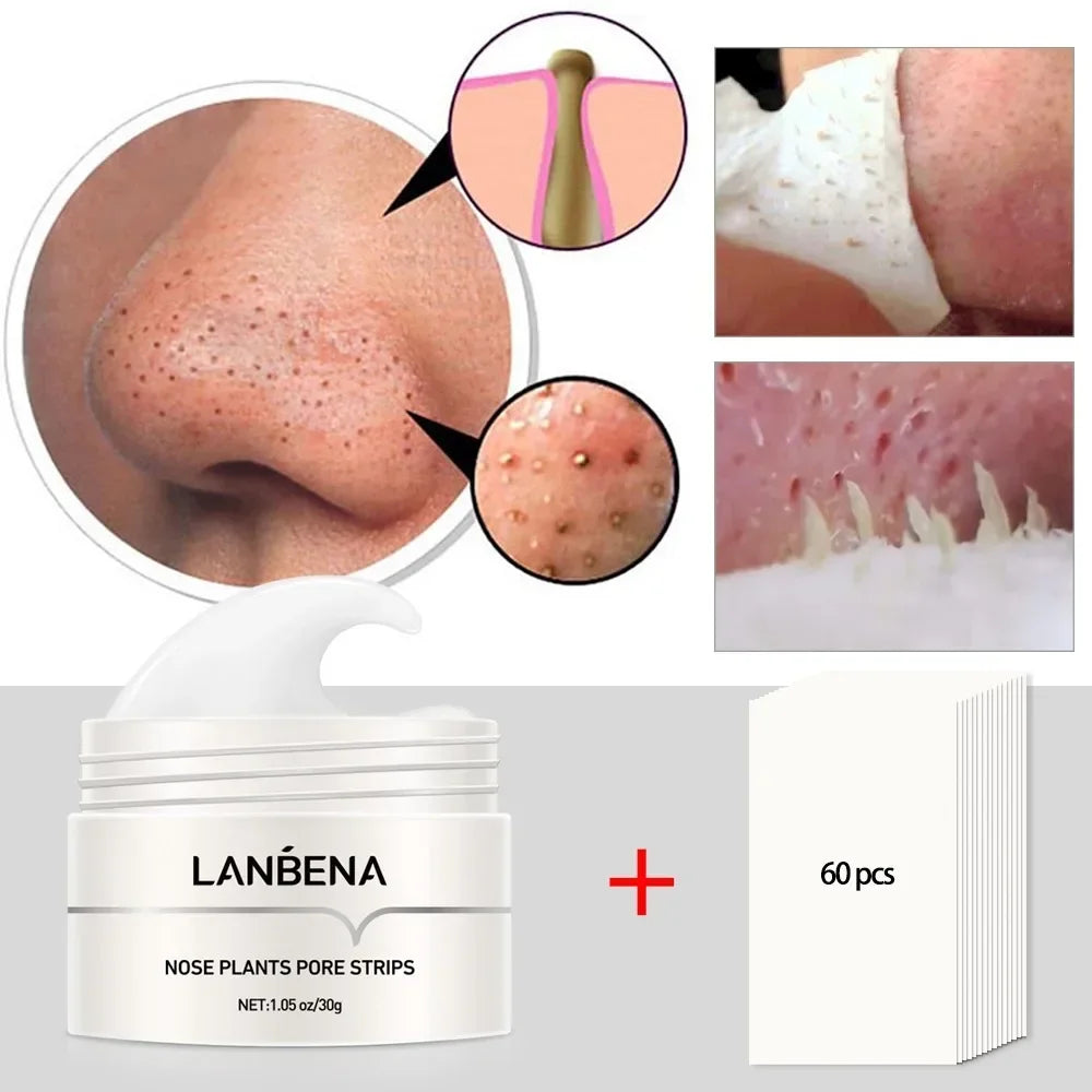 blackhead removal videos